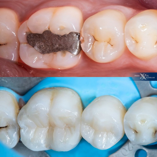 Amalgam Smart Protocol