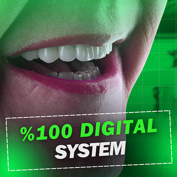 %100 Digital System