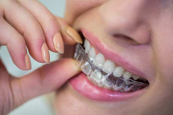 Teeth Grinding & Joint Pain Teeth Grinding & Joint Pain