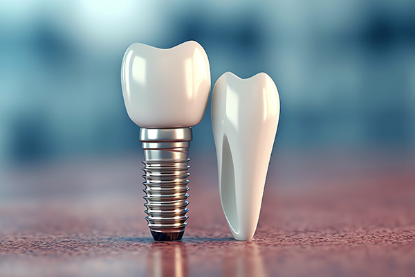 Implant Implant