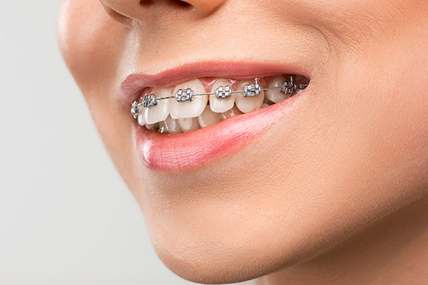 Orthodontics Orthodontics